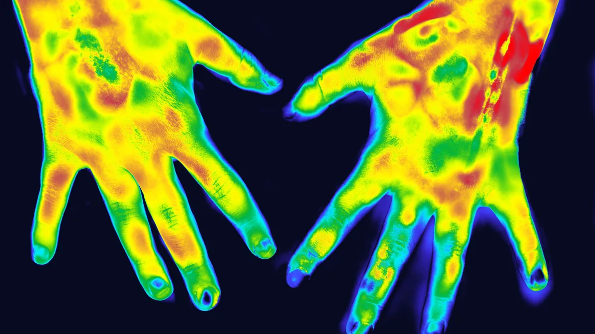 Imagem termográfica de duas mãos mostrando variação de temperatura
